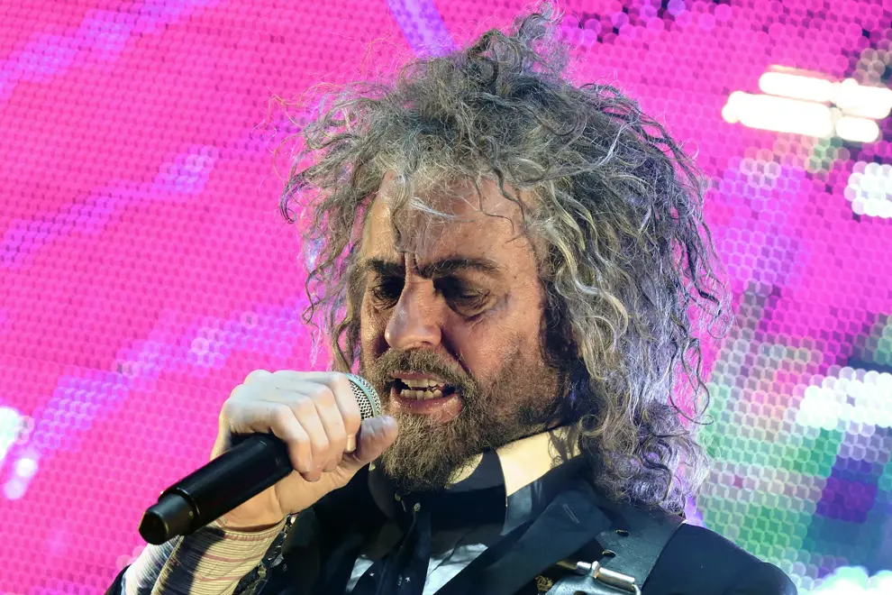 The Flaming Lips