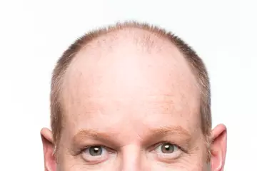 Tom Gleeson